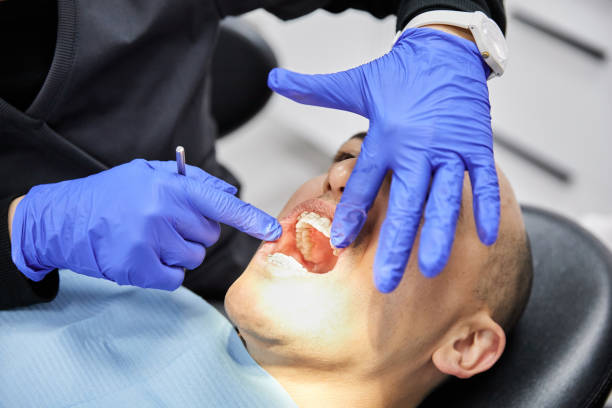 Best Emergency Dentist for Lost Fillings or Crowns in Holly Springs, GA
