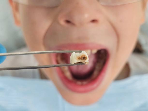 Best Weekend Emergency Dentist in Holly Springs, GA